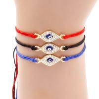 uploads/erp/collection/images/Fashion Jewelry/zuowen/XU0511209/img_b/XU0511209_img_b_2